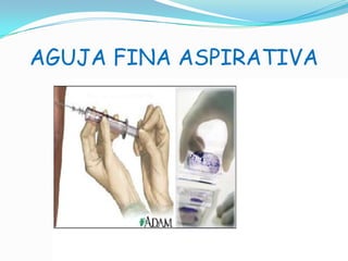 AGUJA FINA ASPIRATIVA