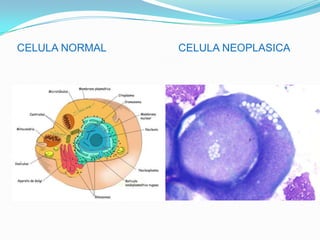 BIBLIOGRAFIAENZO clinical Labwww.enzo.comRobbins, patologiahumana. Octavaedicion