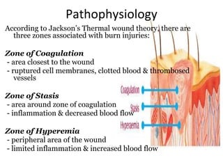 Pathophysiology
According to Jackson’s Thermal wound theory, there are
three zones associated with burn injuries:
Zone of Coagulation
- area closest to the wound
- ruptured cell membranes, clotted blood & thrombosed
vessels
Zone of Stasis
- area around zone of coagulation
- inflammation & decreased blood flow
Zone of Hyperemia
- peripheral area of the wound
- limited inflammation & increased blood flow
 