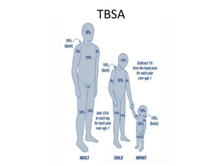 TBSA
 