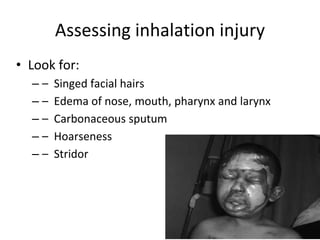 Assessing inhalation injury
• Look for:
– – Singed facial hairs
– – Edema of nose, mouth, pharynx and larynx
– – Carbonaceous sputum
– – Hoarseness
– – Stridor
 