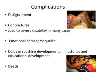 Complications
• Disfigurement
• Contractures
– Lead to severe disability in many cases
• Emotional damage/sequelae
• Delay in reaching developmental milestones and
educational development
• Death
 