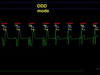 Basic Pacing Concepts | PPT