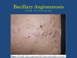Bacillary Angiomatosis
Dr HA – Bs Võ Hoàng Anh
 