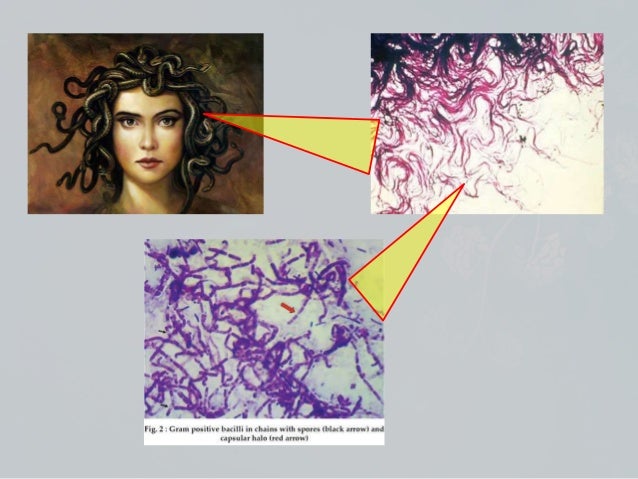 Bacillus