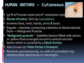 HUMAN ANTHRX – Cutaneous
 95 % of human cases are of cutaneous type.
 Route of entry: Skin by inoculation.
 Involves face, neck, hands, arms & back.
 Papule Vesicles containing colorless or blood stained
fluid Malignant Pustule.
 ‘Malignant pustule’ – Satellite lesions filled with serum
or yellow fluid arranged around a central necrotic
lesion which is covered by a black Eschar.
 Also known as ‘Hide Porter’s Disease’.
 Resolves spontaneously, 10-20% of untreated may
develop fatal septicemia or meningitis.
 