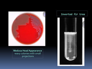 Medusa HeadAppearance
-wavy colonies with small
projections
Inverted fir tree
 