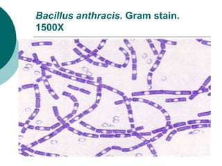 Bacillus anthracis. Gram stain.
1500X
 