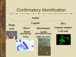 Confirmatory Identification Isolate Phage lysis Capsule Bicarbonate  media Horse  blood (McFadyean  Stain) (McFadyean stain  India ink stain) DFA Capsule antigen Cell wall 