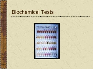 Biochemical Tests 