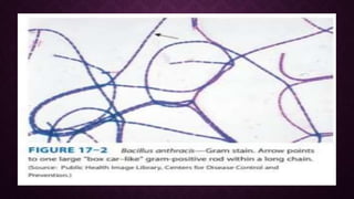 Bacillus Anthracis Bacteria Microbiology Lecture