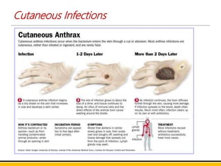 Cutaneous Infections
 