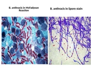 B. anthracis in McFadyean
Reaction
B. anthracis in Spore stain
 