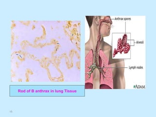 15
Rod of B anthrax in lung Tissue
 