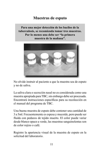 Muestras de esputo

      Para una mejor detección de los bacilos de la
    tuberculosis, se recomienda tomar tres muestras.
         Por lo menos una debe ser “la primera
                 muestra de la mañana”.




No olvide instruir al paciente a que la muestra sea de esputo
y no de saliva.

La saliva clara o secreción nasal no es considerada como una
muestra apropiada para TBC, sin embargo debe ser procesada.
Encontrará instrucciones específicas para su recolección en
el manual del programa de TBC.

Una buena muestra de esputo debe contener una cantidad de
3 a 5ml. Frecuentemente es espesa y mucoide, pero puede ser
fluida con pedazos de tejido muerto. El color puede variar
desde blanco opaco a verde, las muestras sanguinolentas son
de color rojizo o café.

Registre la apariencia visual de la muestra de esputo en la
solicitud del laboratorio.

                              11
 