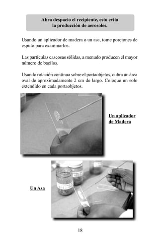 Abra despacio el recipiente, esto evita
              la producción de aerosoles.

Usando un aplicador de madera o un asa, tome porciones de
esputo para examinarlos.

Las partículas caseosas sólidas, a menudo producen el mayor
número de bacilos.

Usando rotación contínua sobre el portaobjetos, cubra un área
oval de aproximadamente 2 cm de largo. Coloque un solo
extendido en cada portaobjetos.




                                             Un aplicador
                                             de Madera




    Un Asa




                             18
 