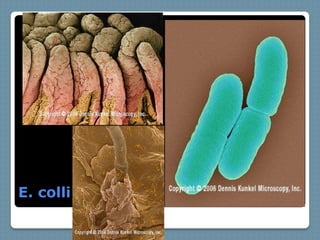 E. colli
 