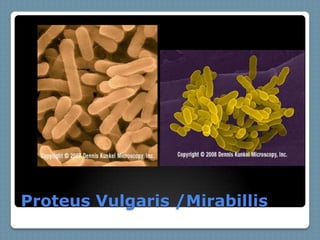 Proteus Vulgaris /Mirabillis
 