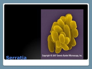 Serratia
 