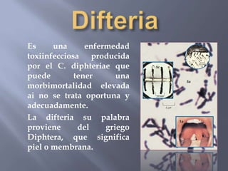 Es     una      enfermedad
toxiinfecciosa producida
por el C. diphteriae que
puede        tener      una
morbimortalidad elevada
ai no se trata oportuna y
adecuadamente.
La difteria su palabra
proviene      del    griego
Diphtera, que significa
piel o membrana.
 