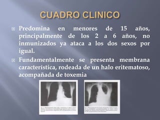    Predomina en menores de 15 años,
    principalmente de los 2 a 6 años, no
    inmunizados ya ataca a los dos sexos por
    igual.
   Fundamentalmente se presenta membrana
    característica, rodeada de un halo eritematoso,
    acompañada de toxemia
 