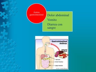 Ántrax
gastrointestinal   Dolor abdominal
                   Vomito
                   Diarrea con
                   sangre




                   karla veloz garcia
 