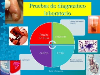 Pruebas de diagnostico
                 laboratorio
                                                • Liquido, pus, sangre
                                                  o esputo




                Prueba
                                  muestras
                de Elisa



                cultivo             Frotis
• Agar sangre                                   • Tinción de gram o
                                                  inmunofluorecencia




                           karla veloz garcia
 