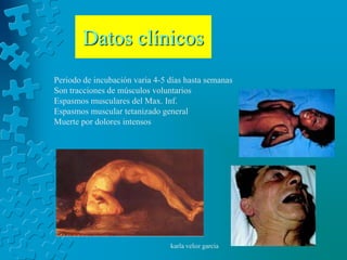 Datos clínicos
Periodo de incubación varia 4-5 días hasta semanas
Son tracciones de músculos voluntarios
Espasmos musculares del Max. Inf.
Espasmos muscular tetanizado general
Muerte por dolores intensos




                                karla veloz garcia
 