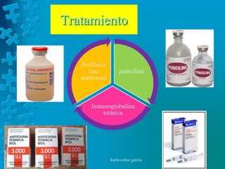 Tratamiento


   Profilaxis
      con           penicilina
   antitoxina



       Inmunoglobulina
           tetánica




                karla veloz garcia
 