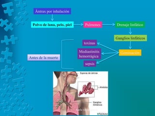 Ántrax por inhalación


  Polvo de lana, pelo, piel          Pulmones      Drenaje linfático


                                                   Ganglios linfáticos
                                    toxinas

                                Mediastinitis         Geminación
Antes de la muerte              hemorrágica
                                     sepsis




                              karla veloz garcia
 