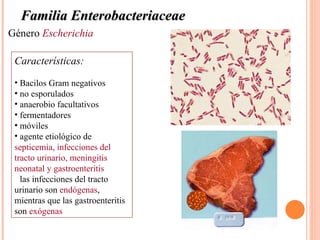 Familia Enterobacteriaceae
Género Escherichia

 Características:
 • Bacilos Gram negativos
 • no esporulados
 • anaerobio facultativos
 • fermentadores
 • móviles
 • agente etiológico de
 septicemia, infecciones del
 tracto urinario, meningitis
 neonatal y gastroenteritis
 • las infecciones del tracto
 urinario son endógenas,
 mientras que las gastroenteritis
 son exógenas
 