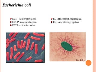 Escherichia coli


     ECET: enterotoxígena   ECEH: enterohemorrágica
     ECEP: enteropatógena   ECEA: enteroagregativa
     ECEI: enteroinvasiva
 