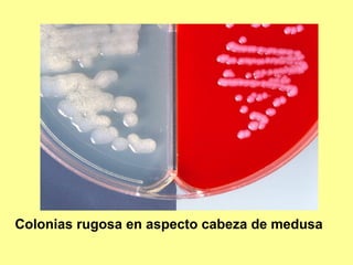 Colonias rugosa en aspecto cabeza de medusa

 