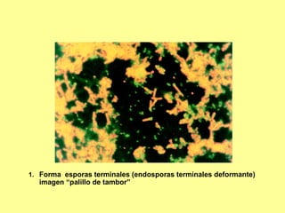 1. Forma esporas terminales (endosporas terminales deformante)

imagen “palillo de tambor”

 