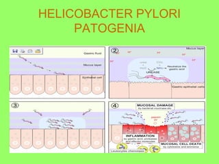 HELICOBACTER PYLORI
PATOGENIA

 