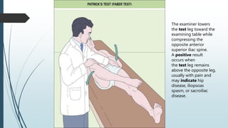 The examiner lowers
the test leg toward the
examining table while
compressing the
opposite anterior
superior iliac spine.
A positive result
occurs when
the test leg remains
above the opposite leg,
usually with pain and
may indicate hip
disease, iliopsoas
spasm, or sacroiliac
disease.
 
