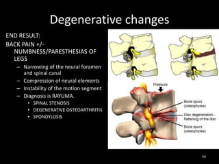Degenerative changes
END RESULT:
BACK PAIN +/-
NUMBNESS/PARESTHESIAS OF
LEGS
– Narrowing of the neural foramen
and spinal canal
– Compression of neural elements
– Instability of the motion segment
– Diagnosis is RAYUMA.
• SPINAL STENOSIS
• DEGENERATIVE OSTEOARTHRITIS
• SPONDYLOSIS
56
 