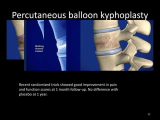 Percutaneous balloon kyphoplasty
77
Recent randomized trials showed good improvement in pain
and function scores at 1 month follow-up. No difference with
placebo at 1 year.
 