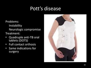 Pott’s disease
88
Problems:
Instability
Neurologic compromise
Treatment:
• Quadruple anti-TB oral
tablets (DOTS)
• Full contact orthosis
• Same indications for
surgery
 