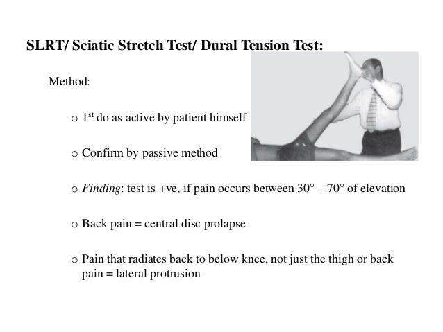 sciatica leg test