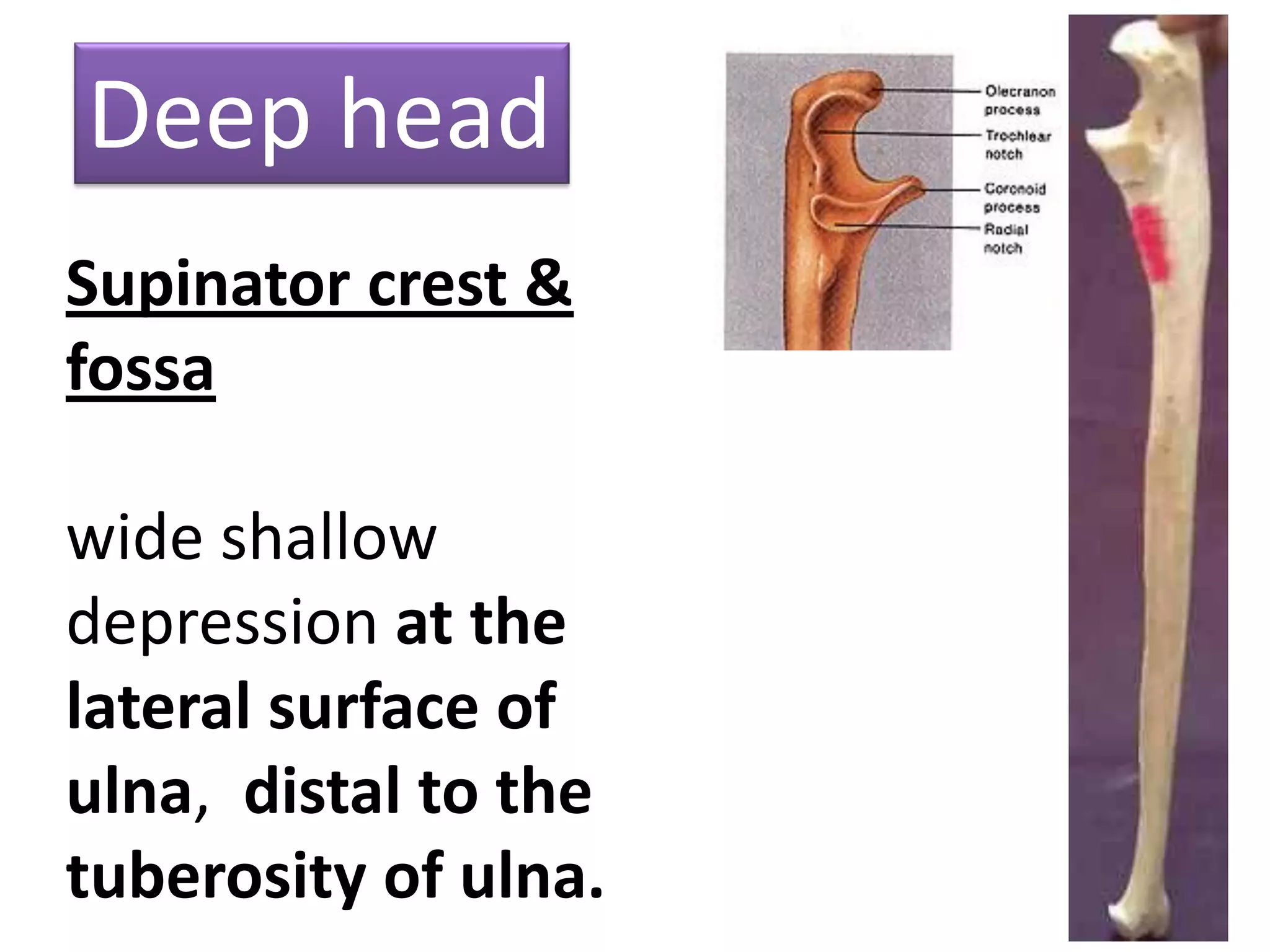 16
Supinator crest &
fossa
wide shallow
depression at the
lateral surface of
ulna, distal to the
tuberosity of ulna.
Deep head
 