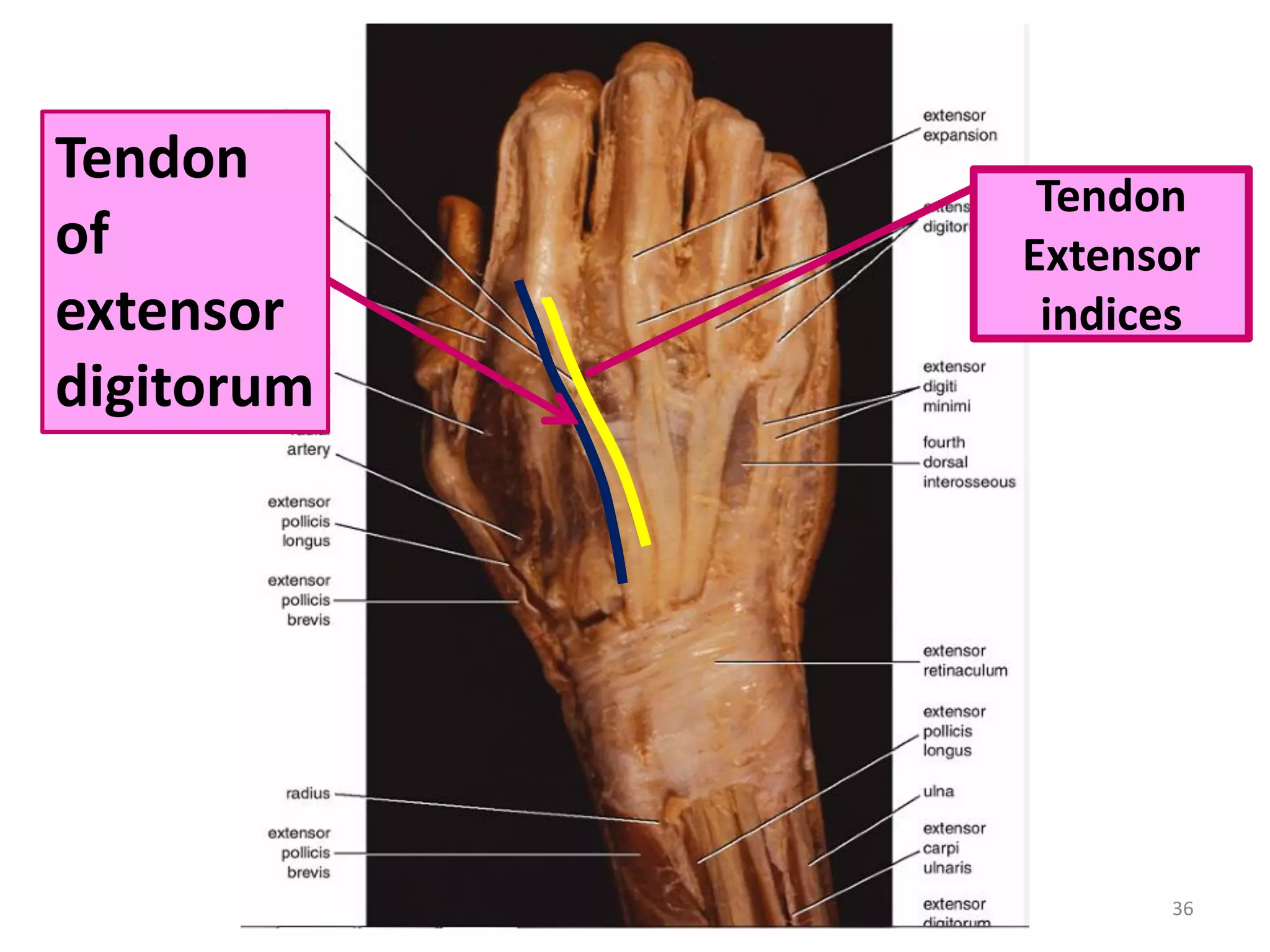 36
Tendon
Extensor
indices
Tendon
of
extensor
digitorum
 
