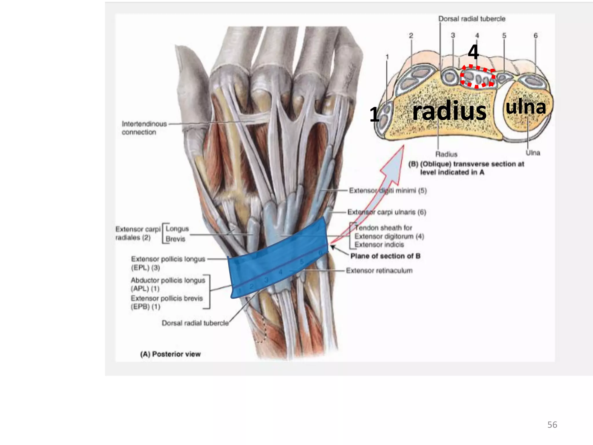56
radius ulna
4
1
 