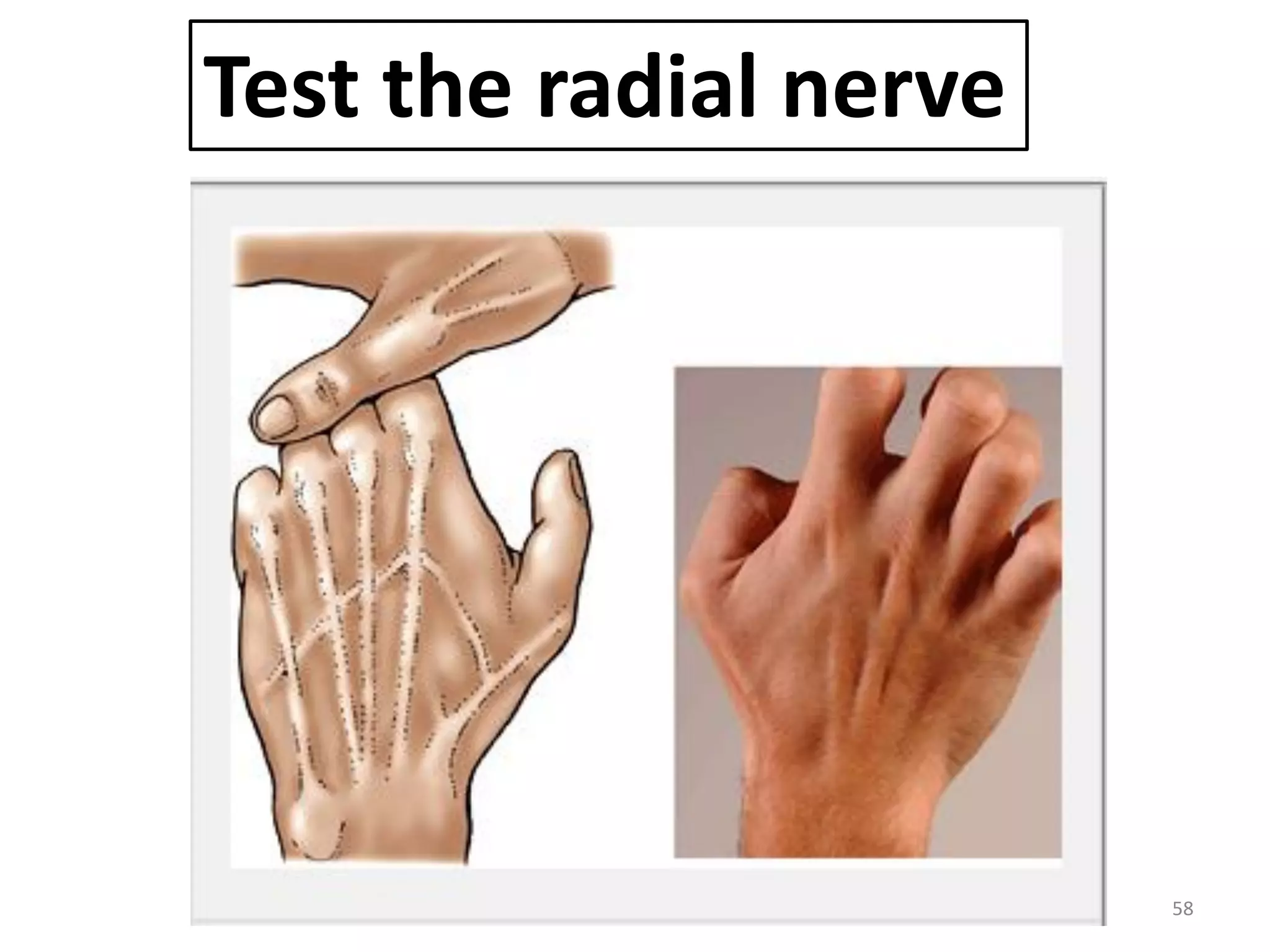 58
Test the radial nerve
 