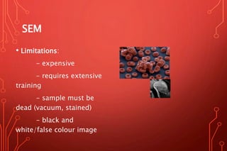 SEM
• Limitations:
- expensive
- requires extensive
training
- sample must be
dead (vacuum, stained)
- black and
white/false colour image
 