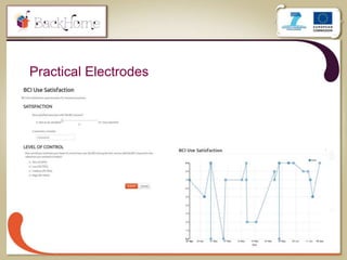 37
Practical Electrodes
 