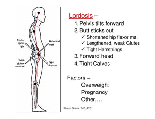 10/6/2010 Sharon Sharpe, ScD, ATC
Lordosis –
1.Pelvis tilts forward
2.Butt sticks out
Shortened hip flexor ms.
Lengthened, weak Glutes
Tight Hamstrings
3.Forward head
4.Tight Calves
Factors –
Overweight
Pregnancy
Other….
 