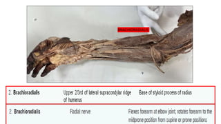 BRACHIORADIALIS
 