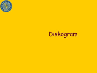 Diskogram 
