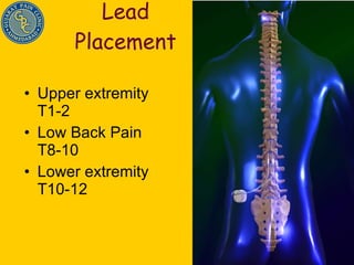 Lead Placement Upper extremity T1-2 Low Back Pain T8-10 Lower extremity T10-12 